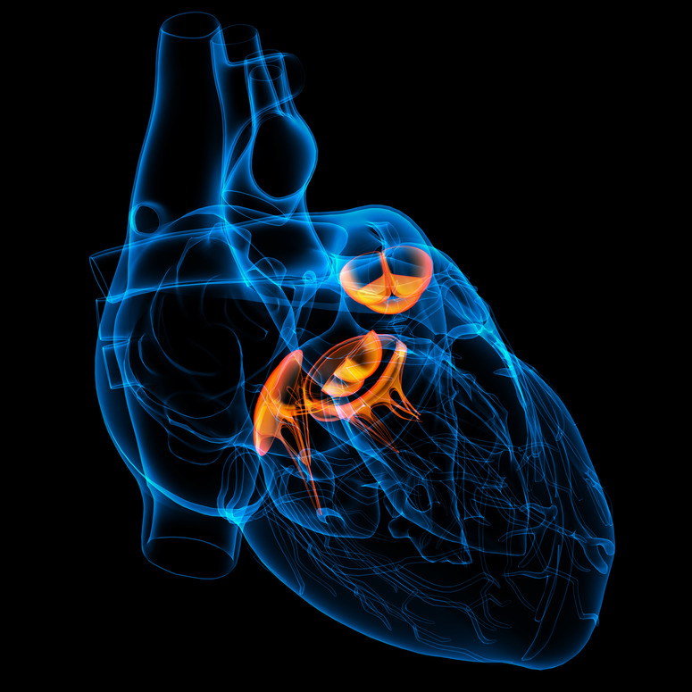 Heart Valve disease management